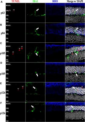 Chronic Proinflammatory Signaling Accelerates the Rate of Degeneration in a Spontaneous Polygenic Model of Inherited Retinal Dystrophy